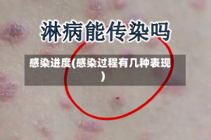 感染进度(感染过程有几种表现)