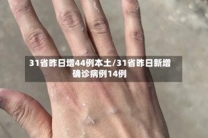 31省昨日增44例本土/31省昨日新增确诊病例14例