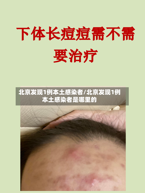 北京发现1例本土感染者/北京发现1例本土感染者是哪里的-第1张图片