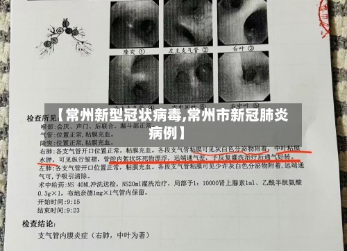 【常州新型冠状病毒,常州市新冠肺炎病例】-第1张图片