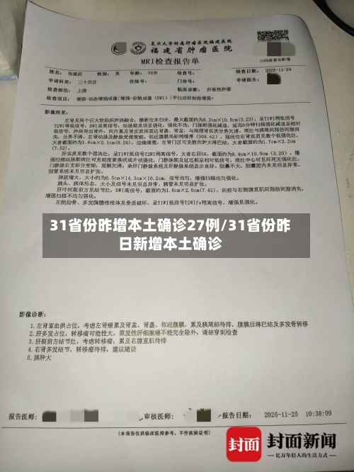 31省份昨增本土确诊27例/31省份昨日新增本土确诊-第1张图片